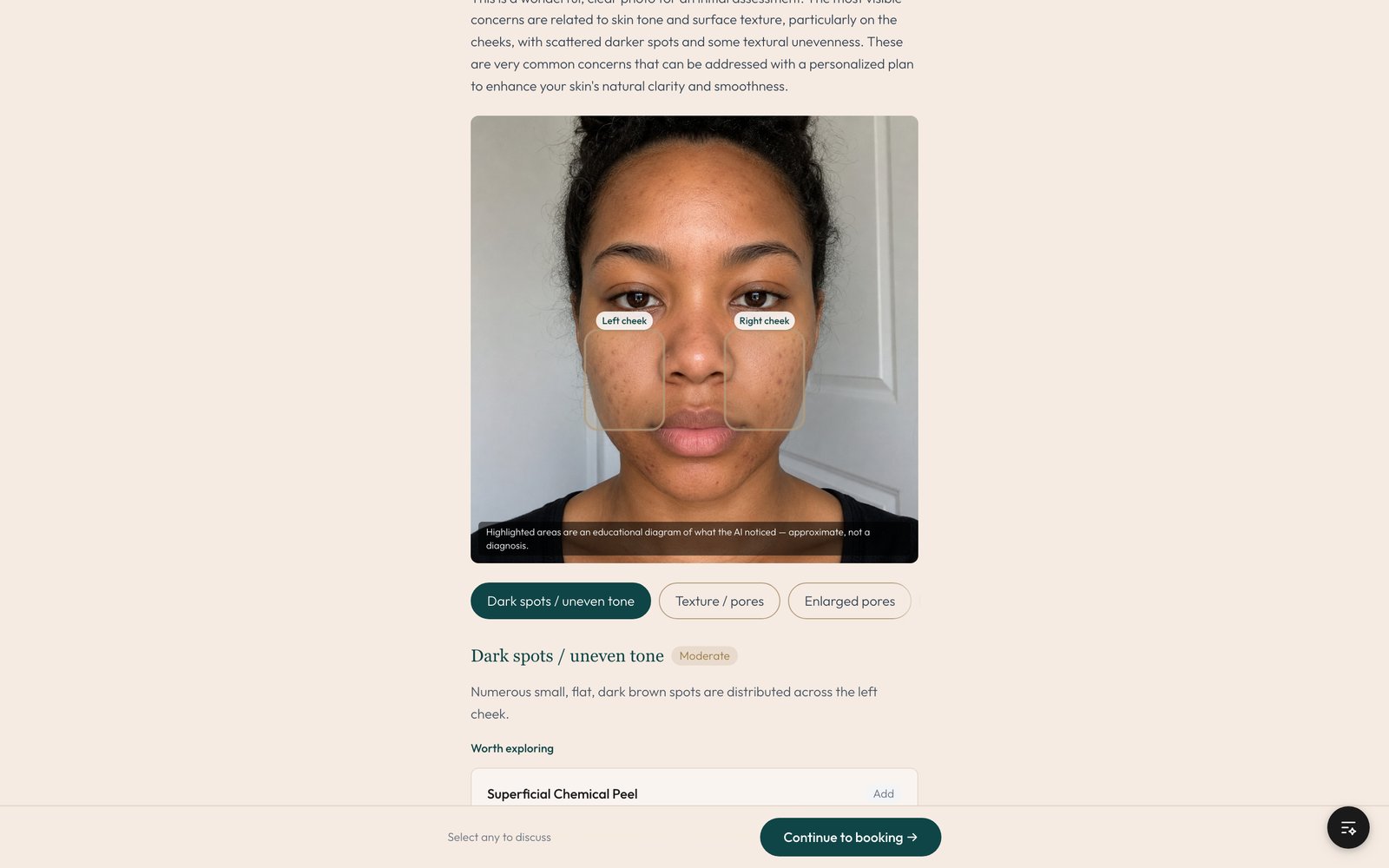 The Kintsu consultation result for one concern: the photo with the concern zone marked, a Dark spots / uneven tone read marked Moderate, a Fitzpatrick-aware explanation written for richer tones, and a Worth exploring service drawn from the practice catalog.