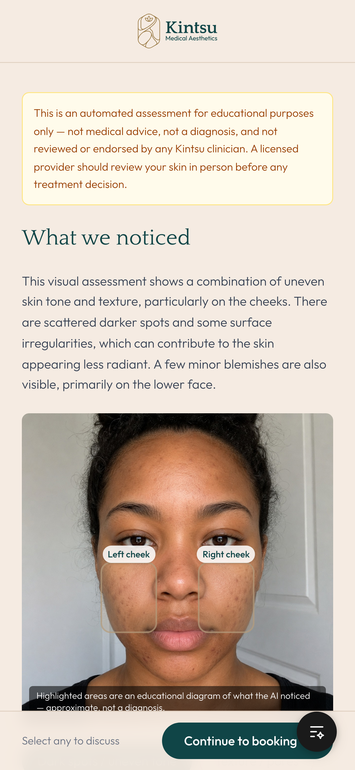 Kintsu mobile result screen showing what the AI noticed with the concern overlay drawn on the face, the app logo visible at the top.