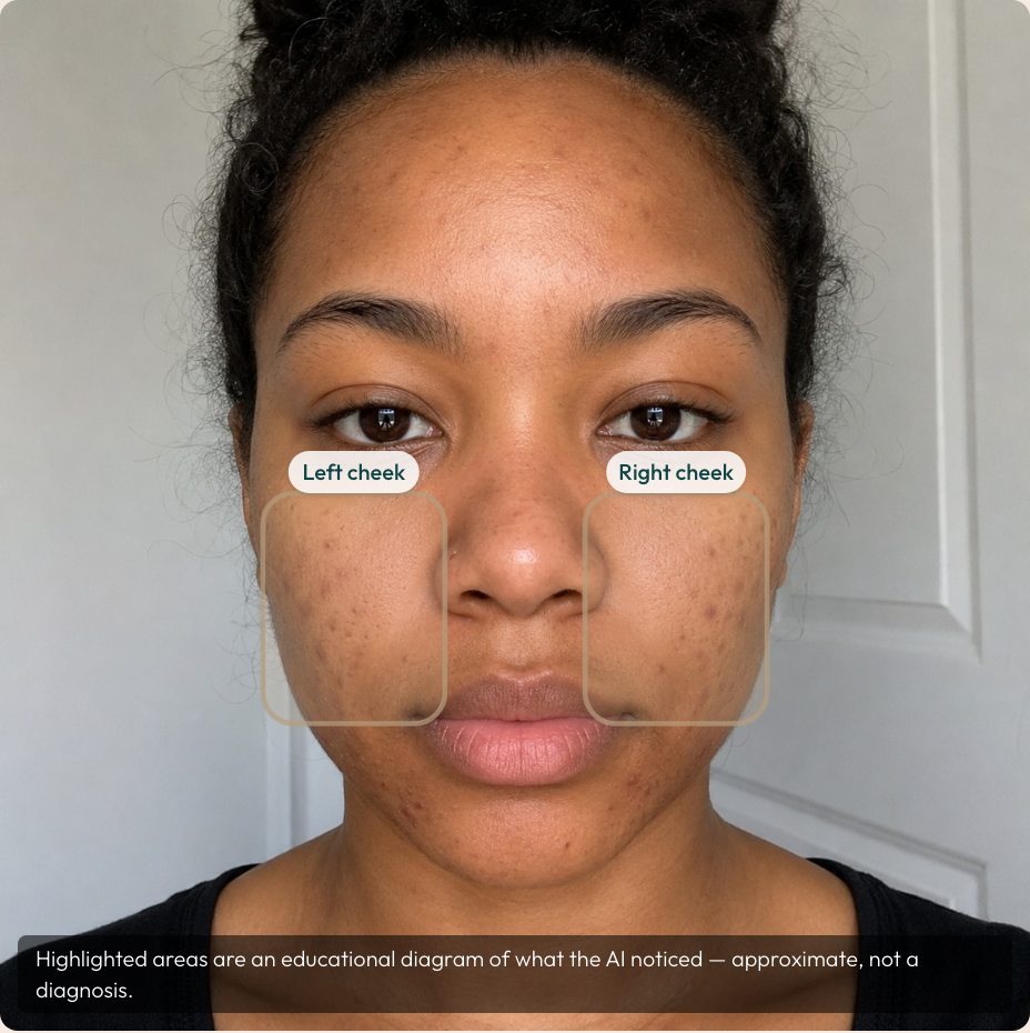 A selfie with the Kintsu educational overlay drawn over it client-side: a soft-gold concern region across the cheeks, plain-language Left cheek and Right cheek labels, and a footer note reading that highlighted areas are an educational diagram, approximate and not a diagnosis.